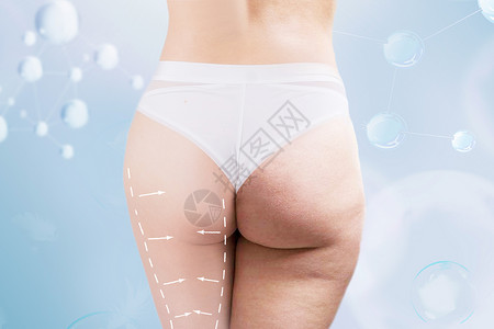 医美对比臀部减肥瘦身设计图片