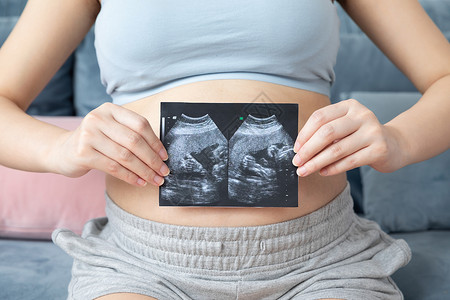 女人怀孕孕妇拿着b超背景