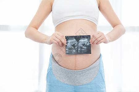 孕妇拿着b超高清图片