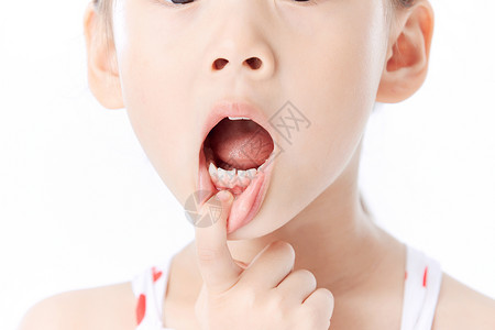 预防龋齿小女孩张嘴巴检查牙齿特写背景