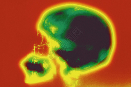 脑部扫描图背景图片