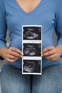 孕妇拿着扫描片背景图片