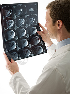 医生看X光片背景图片