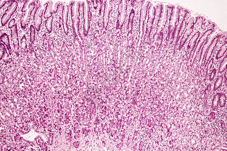 胃粘膜背景