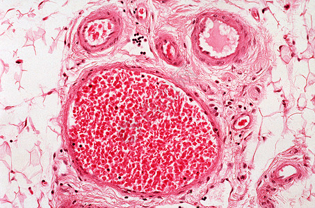 血管医学小动脉高清图片
