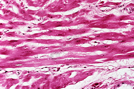 妊娠期子宫肌层图片