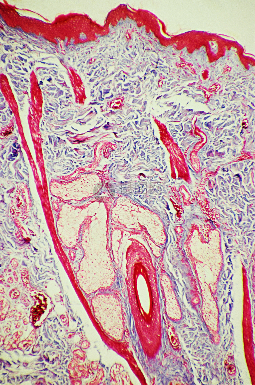显微镜下的皮肤毛囊图片