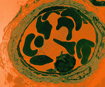 显微镜下的血管图片