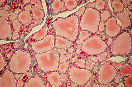 甲状腺素材甲状腺胶体滤泡背景