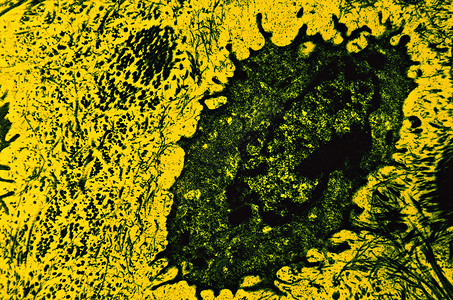 骨细胞透射电子显微照片高清图片