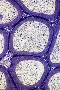 附睾精子小管背景图片
