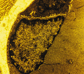肌肉细胞透射电子显微照片高清图片