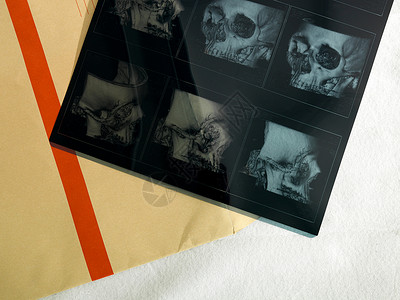 X射线和信封图片