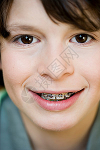 正畸带牙套的肖像男孩背景
