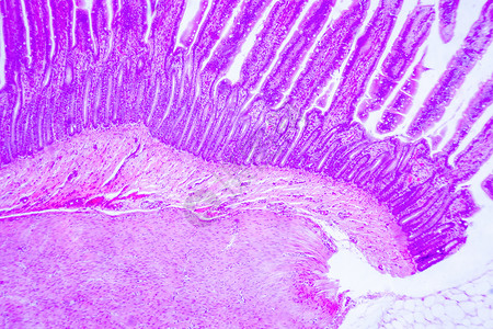 小肠粘膜小肠细胞背景
