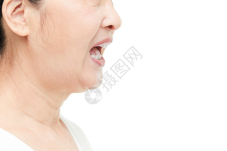牙齿纠正中老年女性露齿特写背景