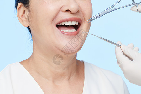 老年女性做牙齿手术图片