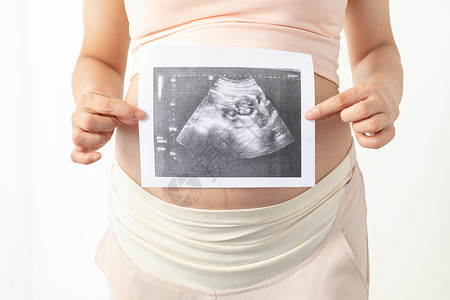 生命的希望孕妇手拿宝宝b超照片背景