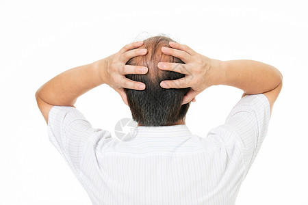 头发稀疏中年男人秃头危机背景