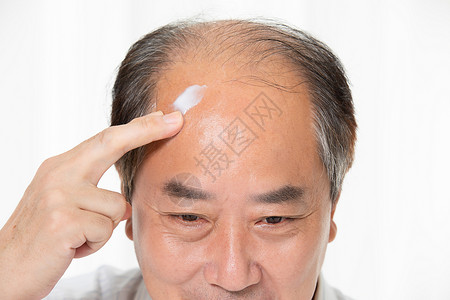 秃头中年男性用增发膏背景