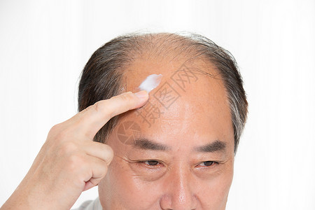 秃头中年男性用增发膏高清图片