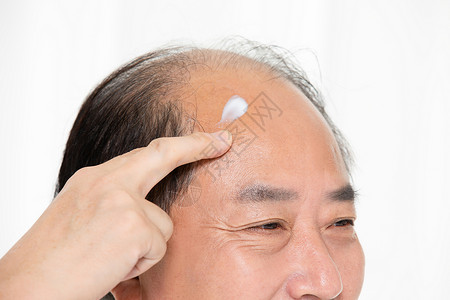 秃头中年男性用增发膏背景