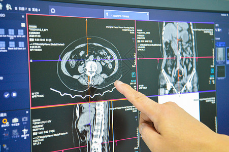 脑部CT片医疗ct监控背景