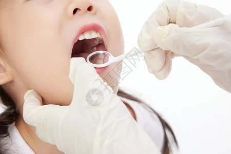 医生检查儿童口腔牙齿健康特写高清图片