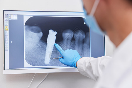 医生指出屏幕上显示的牙齿问题背景图片