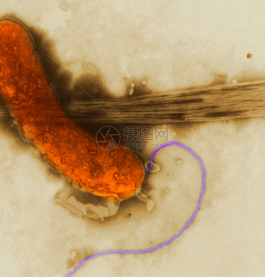 电子显微镜下的细菌图片
