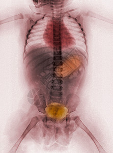 51狂欢周对51周的年幼女婴进行身体X光检查背景