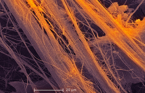石棉电子显微摄影图图片