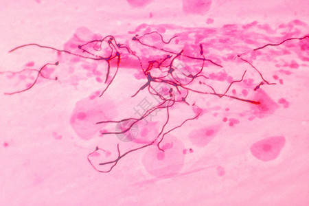 光镜照片肺组织中的白色念珠菌高清图片