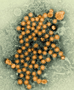 肝炎电子显微图背景