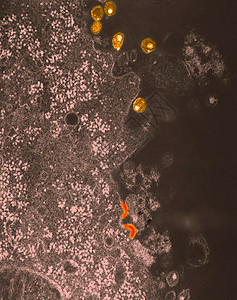 艾滋病毒电子显微图高清图片