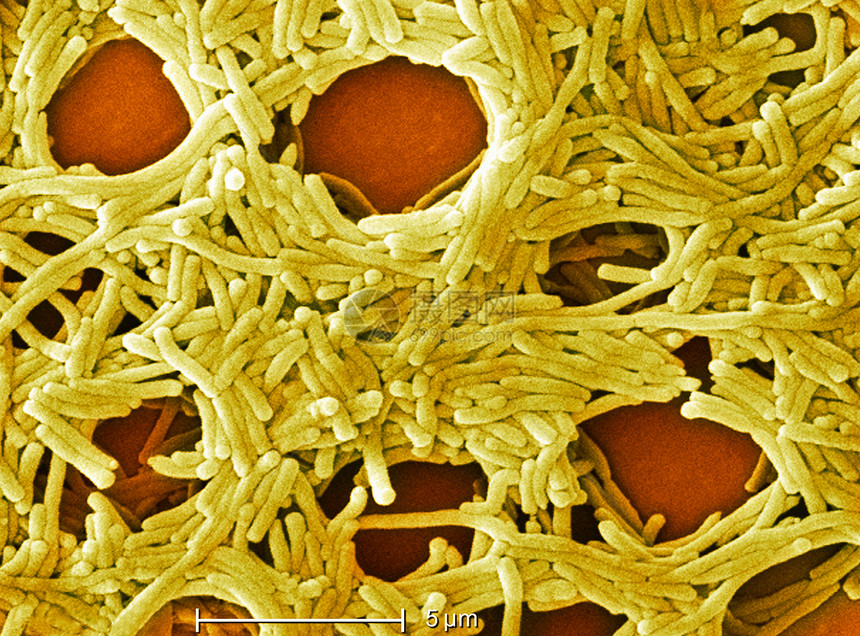 军团细菌电子显微图图片