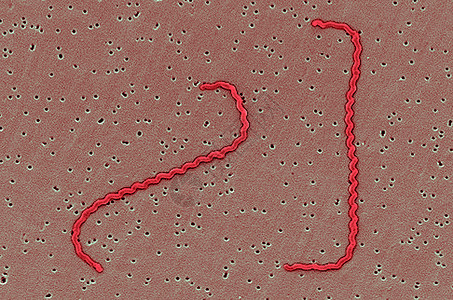 扫描电子显微镜下Leptospira细菌图片