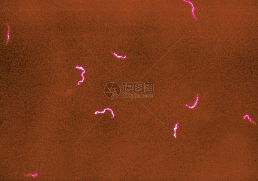 梅毒螺旋体细菌显微照片图片