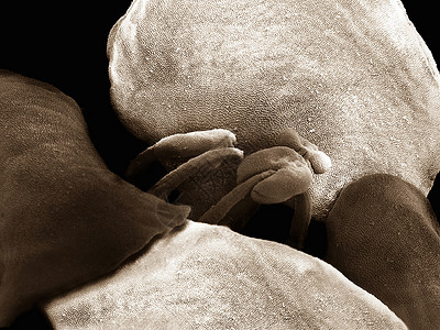 显微镜塞皮亚雪晶的样子图片