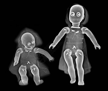 两个娃娃的X光图片