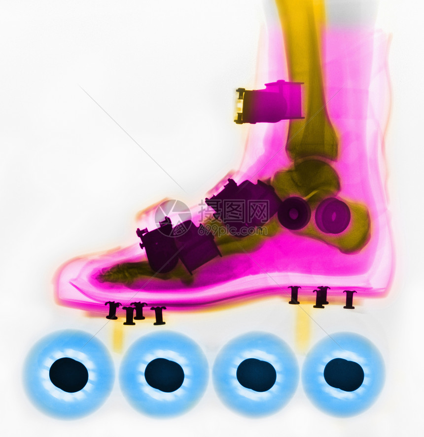 滑冰板内部的X光线图片