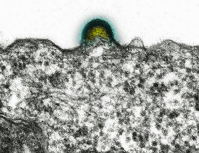 艾滋病TEM毒从淋巴细胞发芽图片