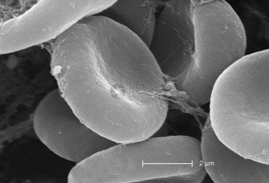 显示红细胞和纤维蛋白的扫描电镜图片