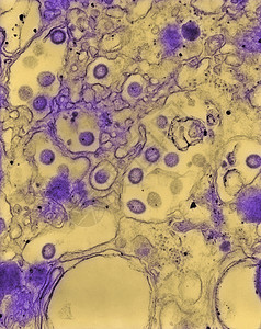 虫媒病毒显微镜下的微生物背景
