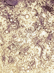透射电镜显微镜下的微生物背景