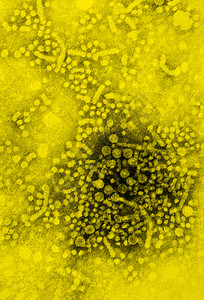 B型肝炎TEM图片