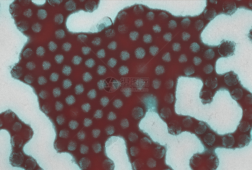 腺病毒光显微图图片