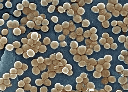 MRSA的SEM抗甲西林的药吸血球菌背景图片
