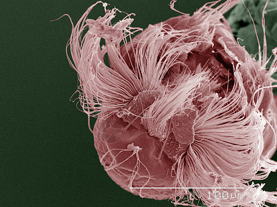 蚊卵的彩色扫描电镜背景图片