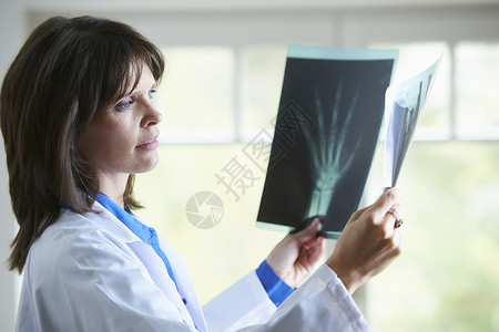 医生看X光图像图片